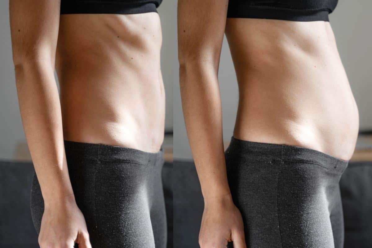 How long does diastasis recti take to improve Lower Feltham?