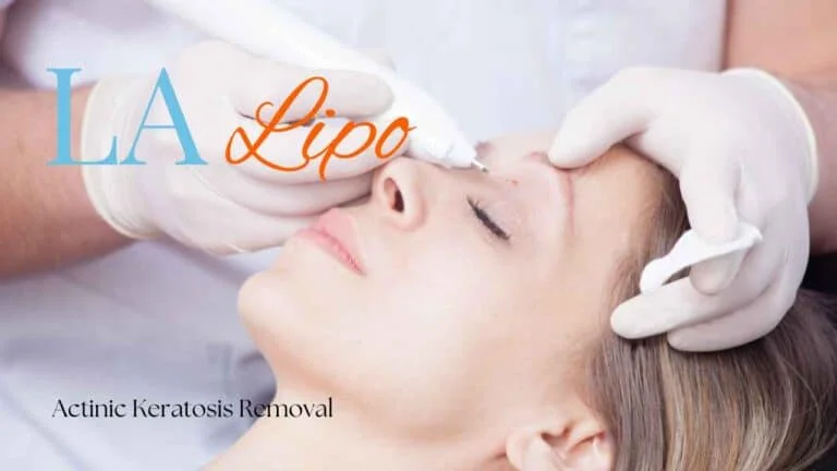 Woman receiving Actinic Keratosis Removal Treatment Lower Feltham
