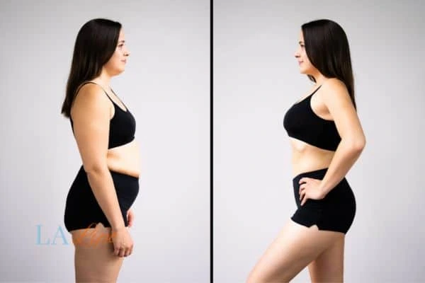 LA-EMS Body Sculpting Lower Feltham results before and after of womans results on body toning.