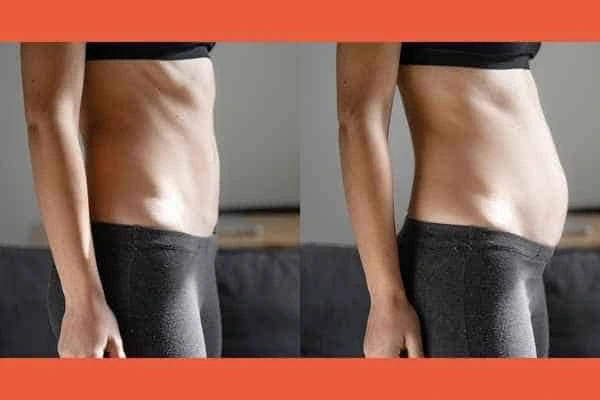 LA-EMS Body Sculpting results Lower Feltham