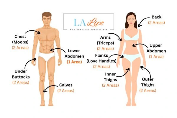 LA LIPO Cryolipolysis Areas Lower Feltham
