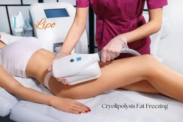Woman receiving coolsculpting Lower Feltham treatment on her thighs