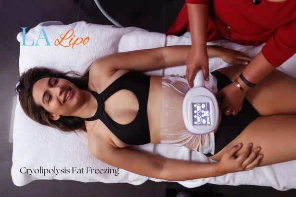 woman getting cryolipolysis Lower Feltham
