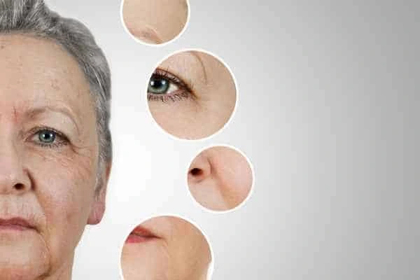 HIFU Facelift Lower Feltham from LA LIPO