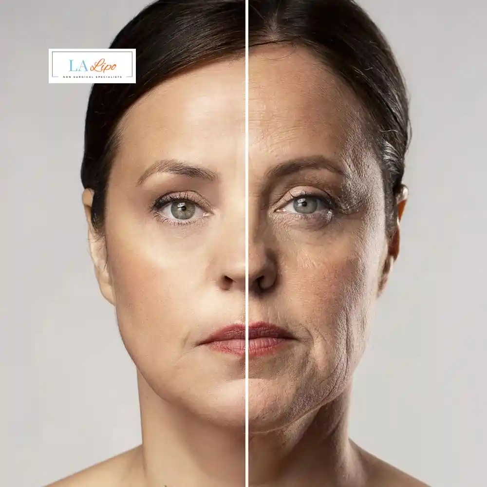 How Can You Tell If Non-Surgical Skin Tightening Is Right for You Lower Feltham?