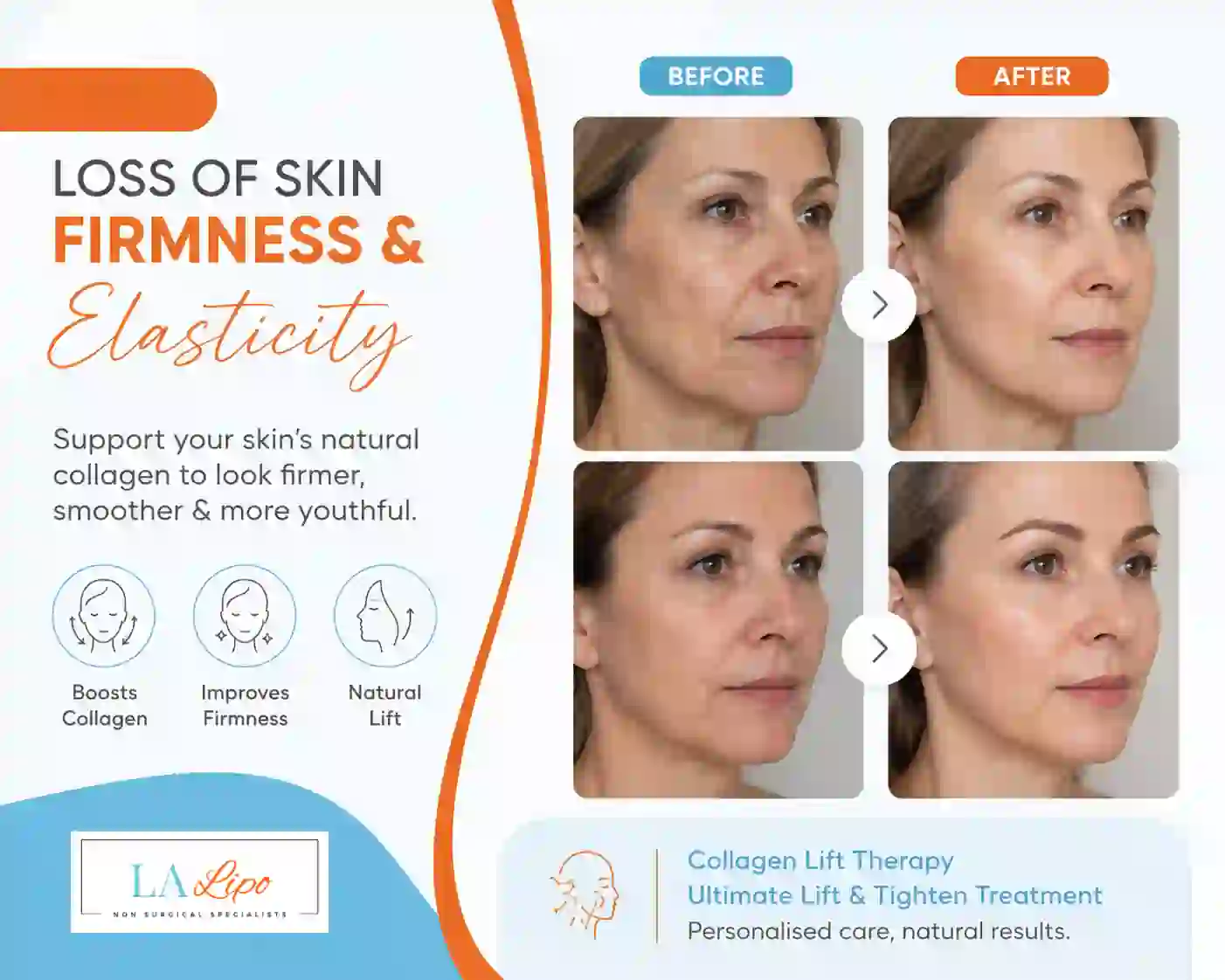 Sign #7: Loss of Skin Firmness and Elasticity Lower Feltham