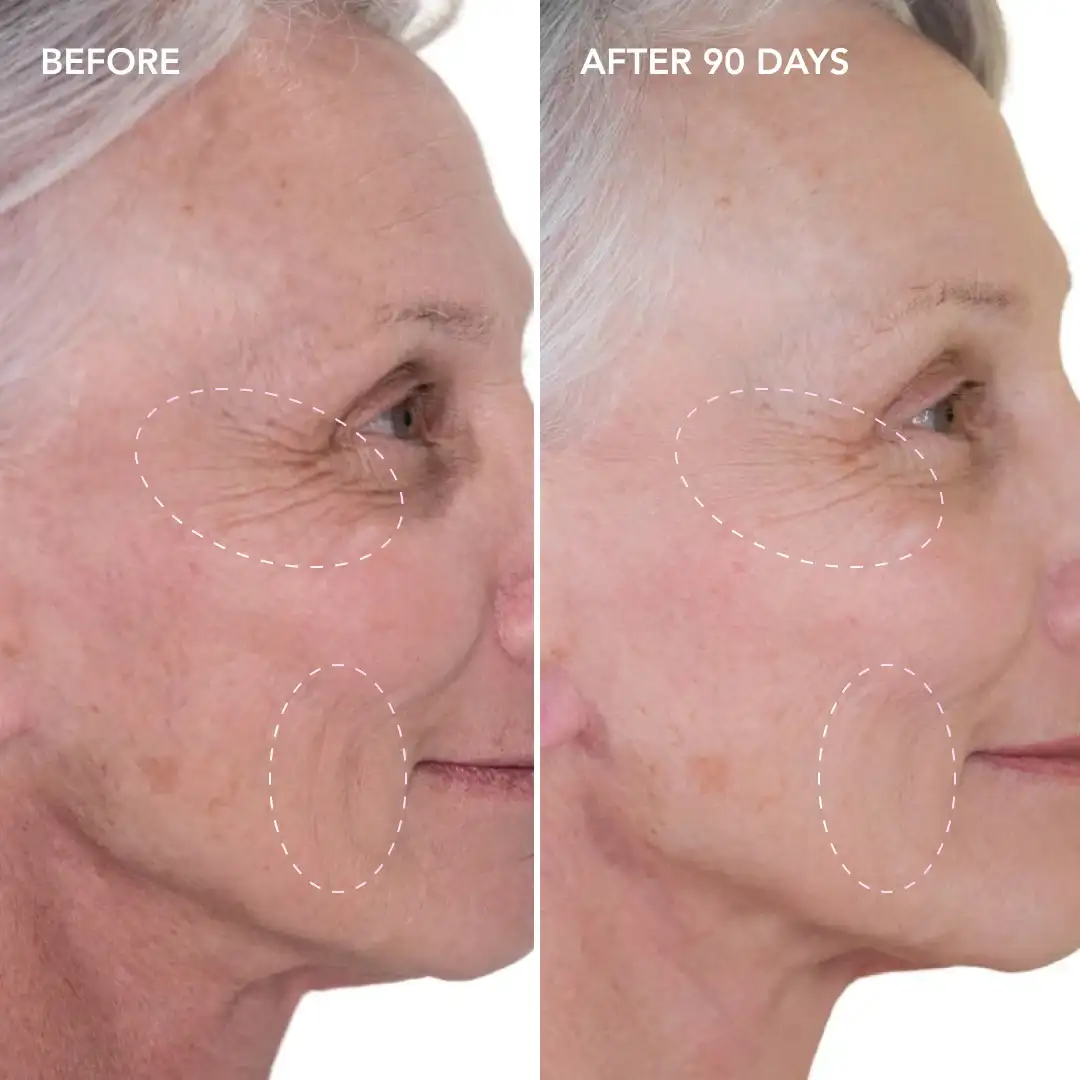 When will you see results Lower Feltham